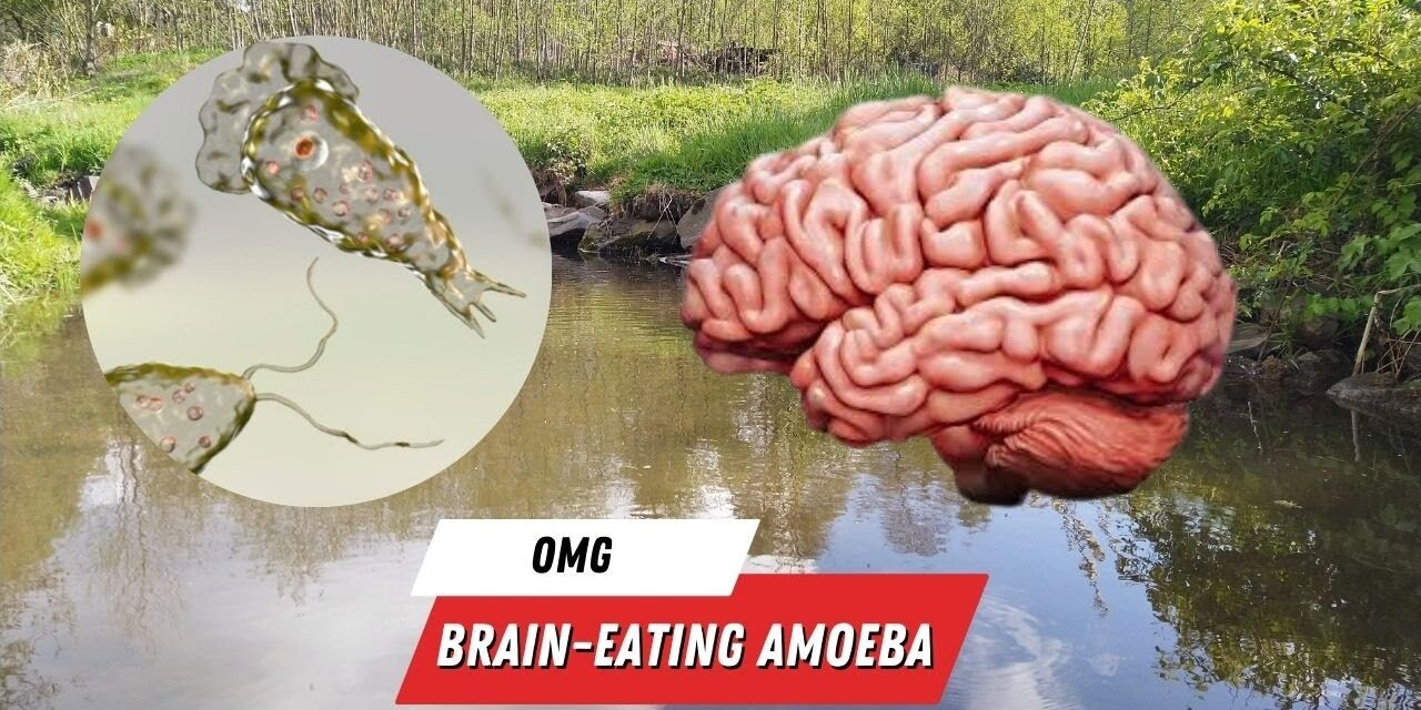 Israel Treats First Living Brain-Eating Amoeba Patient