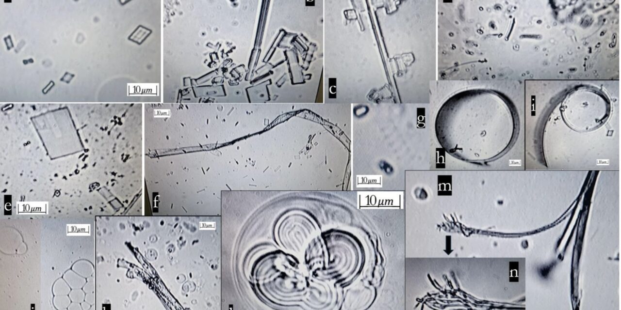 IS THERE A NON SCI FI EXPLANATION FOR THESE PICTURES – FOUND IN PFIZER MRNA?