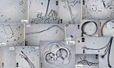 IS THERE A NON SCI FI EXPLANATION FOR THESE PICTURES – FOUND IN PFIZER MRNA?