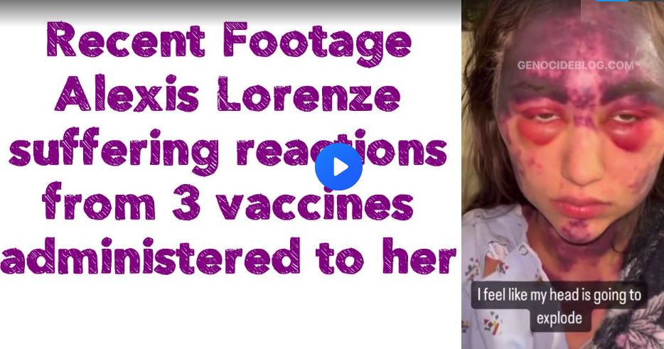 Recent Footage: Alexis Lorenze suffering reactions from 3 vaccines administered to her