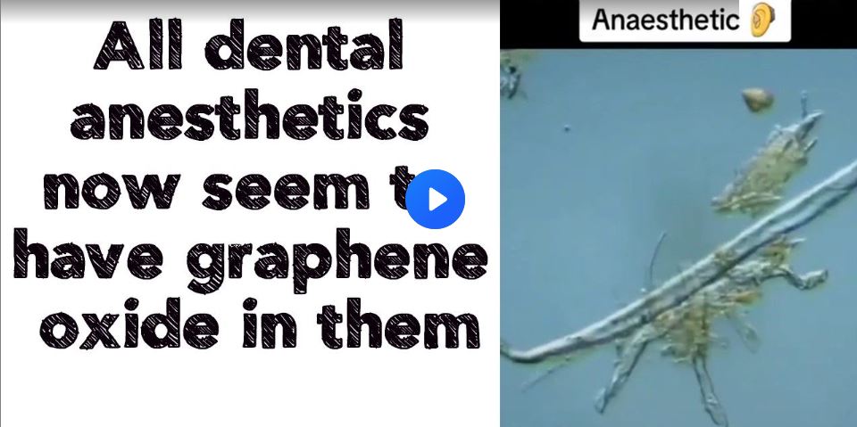 All dental anesthetics now seem to have graphene oxide in them