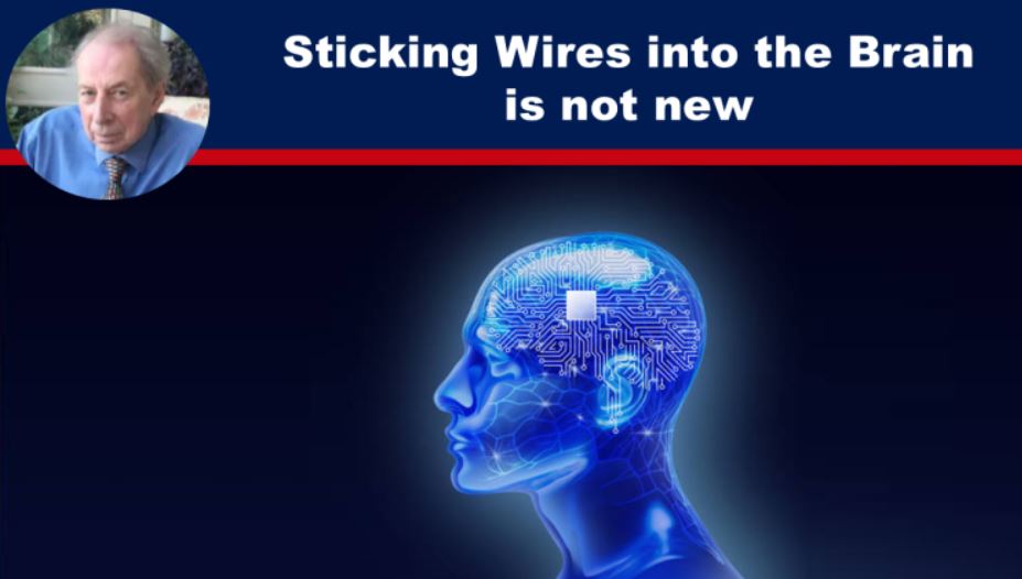 Sticking Wires into the Brain is not new